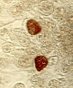 Inclusions (brunes) intracellulaires de chlamydiae trachomatis
